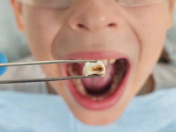 Best Walk-In Emergency Dentist in Round Rock, TX